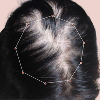 Month 1 Hair Progress