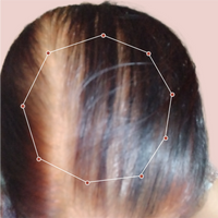 Month 1 Hair Progress