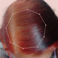 Month 1 Hair Progress