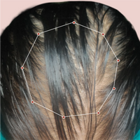 Month 1 Hair Progress