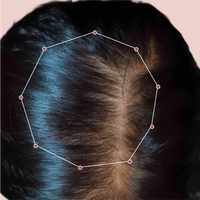 Month 1 Hair Progress