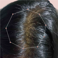 Month 1 Hair Progress