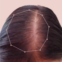 Month 1 Hair Progress