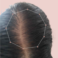 Month 1 Hair Progress