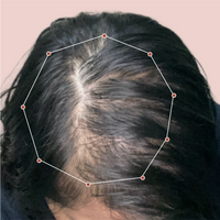 Month 1 Hair Progress
