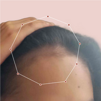 Month 1 Hair Progress