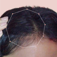 Month 1 Hair Progress