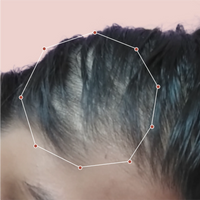 Month 1 Hair Progress