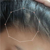 Month 1 Hair Progress