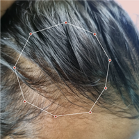 Month 1 Hair Progress