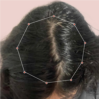 Month 1 Hair Progress
