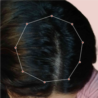 Month 1 Hair Progress