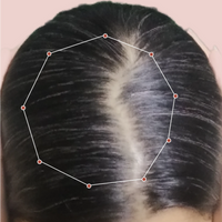 Month 1 Hair Progress