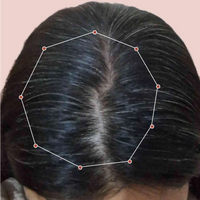 Month 1 Hair Progress