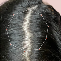 Month 1 Hair Progress