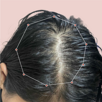 Month 1 Hair Progress