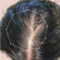 Month 1 Hair Progress