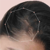 Month 1 Hair Progress