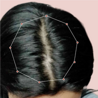 Month 1 Hair Progress