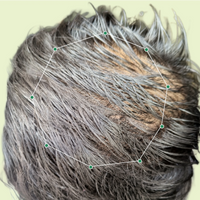 Month 1 Hair Progress