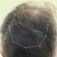 Month 1 Hair Progress