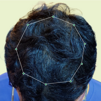 Month 1 Hair Progress