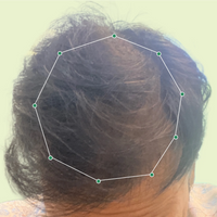 Month 1 Hair Progress