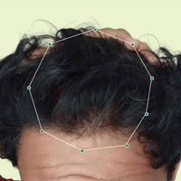 Month 1 Hair Progress
