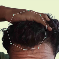 Month 1 Hair Progress