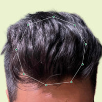 Month 1 Hair Progress