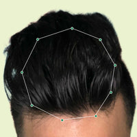 Month 1 Hair Progress