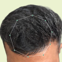 Month 1 Hair Progress