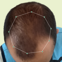 Month 1 Hair Progress
