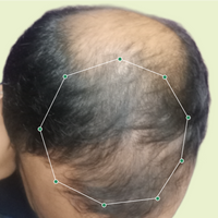 Month 1 Hair Progress
