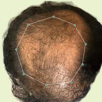 Month 1 Hair Progress